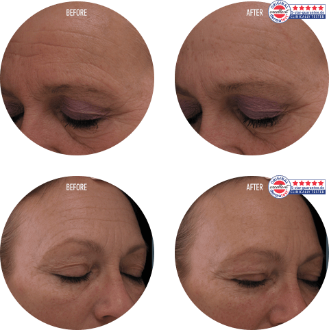 RENU 28 Results: Before & After