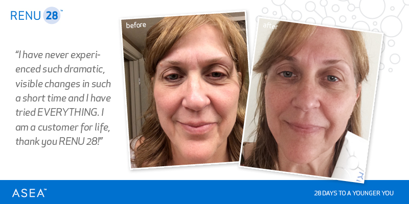 renu anti aging